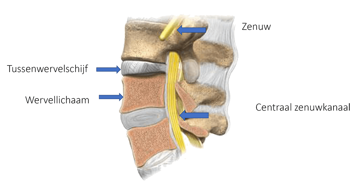 Tussen twee wervels in de wervelkolom zit een tussenwervelschijf.