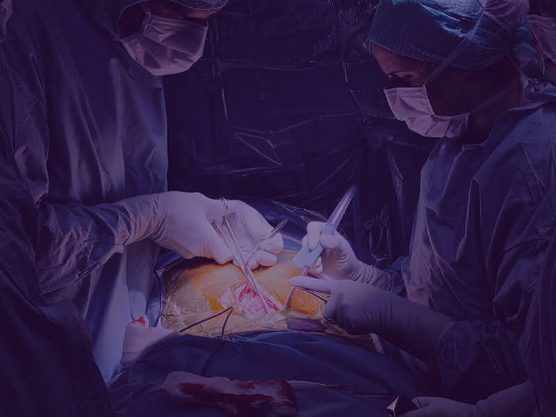 Tijdens de operatie worden kleine incisie (insneden) en spier-sparende technieken gebruikt om bloedverlies te beperken en de postoperatieve pijn te verminderen