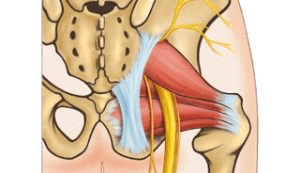 De piriformis spier is een kleine spier in de bil